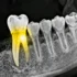 Next-Gen AI Revolutionizes Dental Diagnostics with Advanced Lesion Detection Algorithms