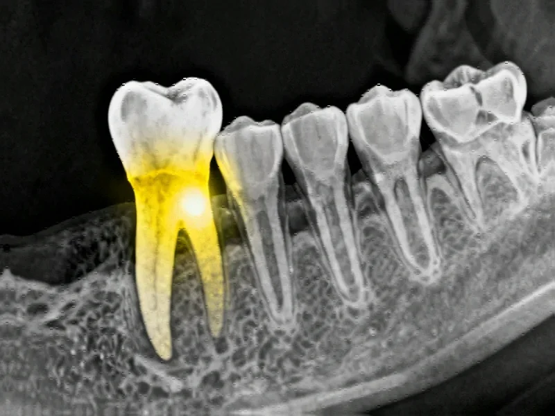 Next-Gen AI Revolutionizes Dental Diagnostics with Advanced Lesion Detection Algorithms - Professional coverage